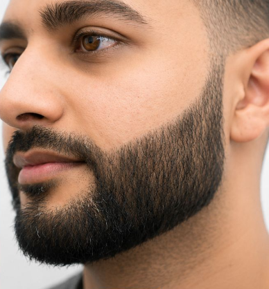 Après greffe de barbe